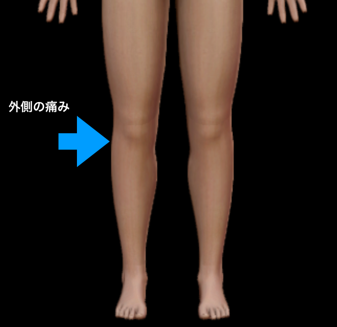 の 外側 が 痛い 膝